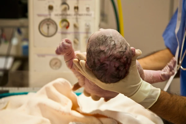 Birth Injuries